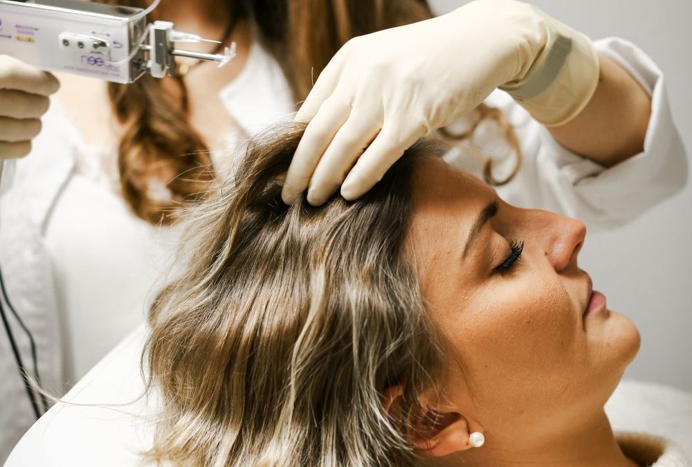 Traiter la calvitie par des injections de PRP