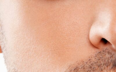 Comment dormir après une greffe capillaire ?