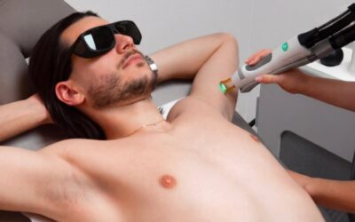 Épilation laser au masculin : peut-on continuer son protocole cet été ?
