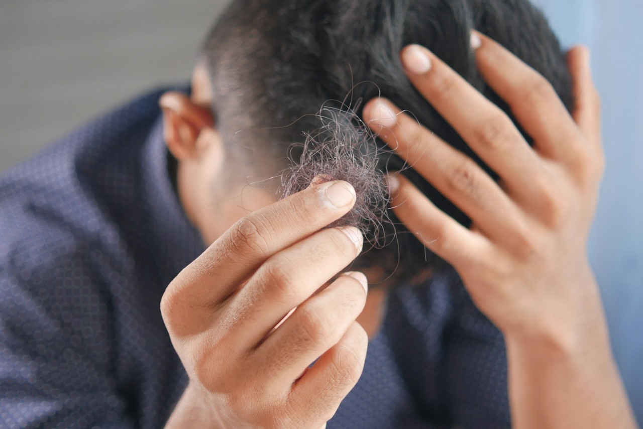 Perdre ses cheveux Perdre ses cheveux